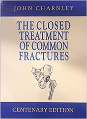 The Closed Treatment Of Common Fractures by John Charnley 2019